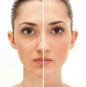 Filters for Skin-Smoothing 