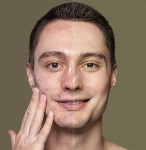 How Lighting Affects Skin-Smoothing