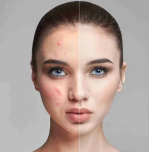 How to Fix Uneven Skin Tones