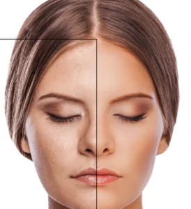 Quick Guide to Skin-Smoothing