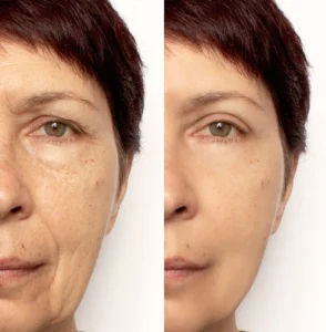 Tips for Perfect Skin-Smoothing
